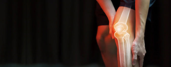 Arthroplasty Joint Replacement