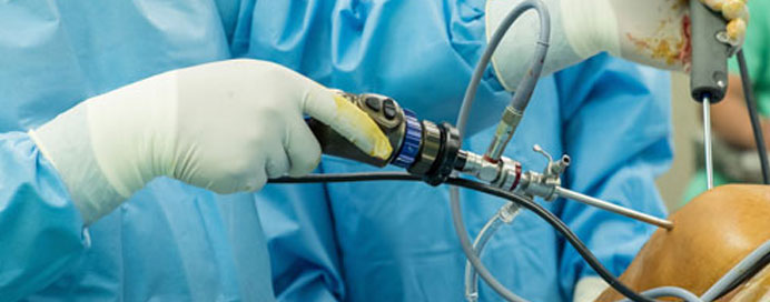 Minimally Invasive Surgery