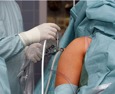 Minimally Invasive Surgery