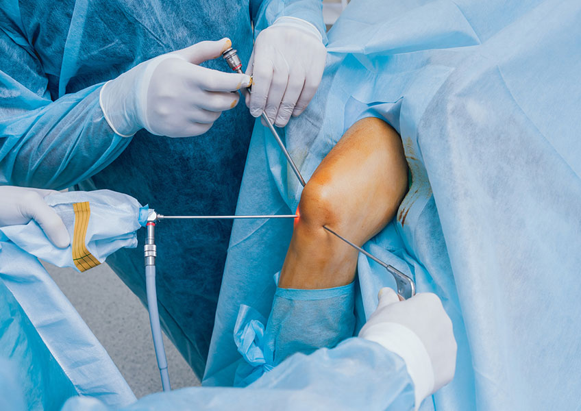 Arthroscopy is a minimally invasive surgical technique...