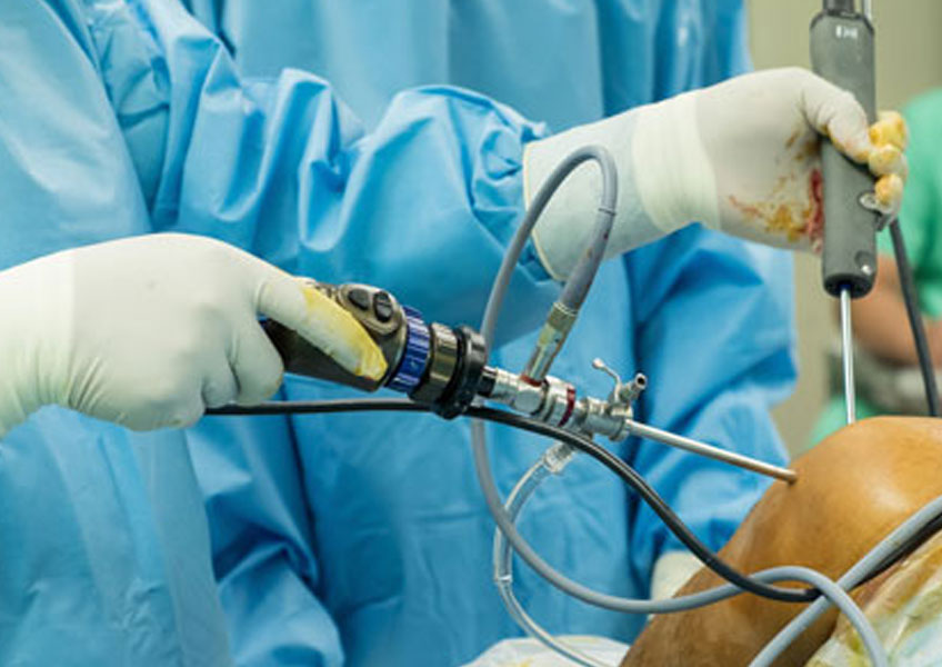 Minimally Invasive Surgery